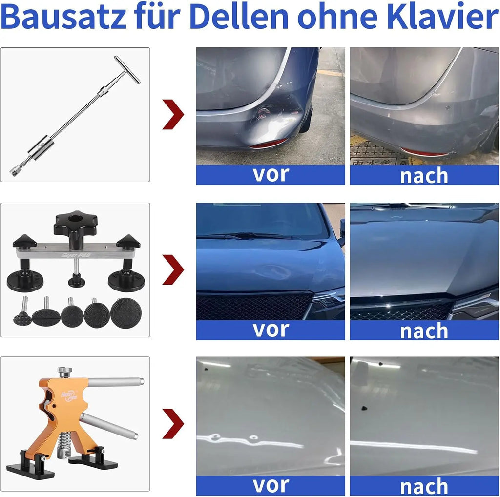 Paintless Dent Repair Pro Set with Glue Gun and Puller Tools