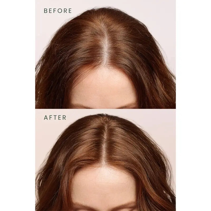 Matsu Rosemary Scalpify Root Mist Hair Tonic 100ml